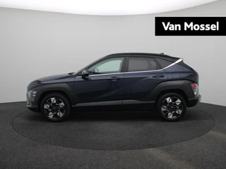 Hyundai Kona financial lease